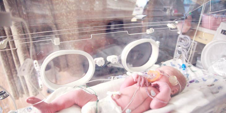A newborn baby lying in a neonatal intensive care unit.