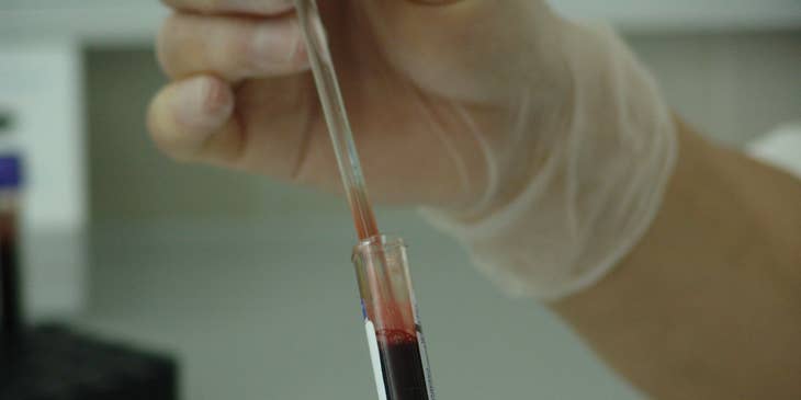 A Forensic Science Technician preparing to perform tests on a collected blood sample evidence from a crime scene.