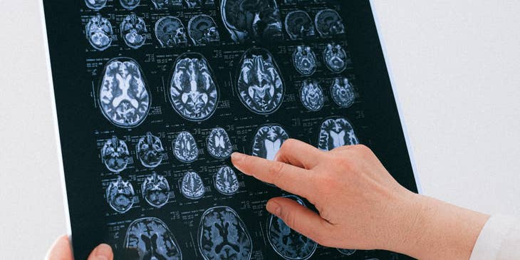 Neurologist interprets the results of neuroimaging.